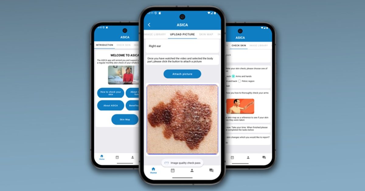 OpenGraph Image for Skin cancer survivors invited to help evaluate new follow-up phone app
