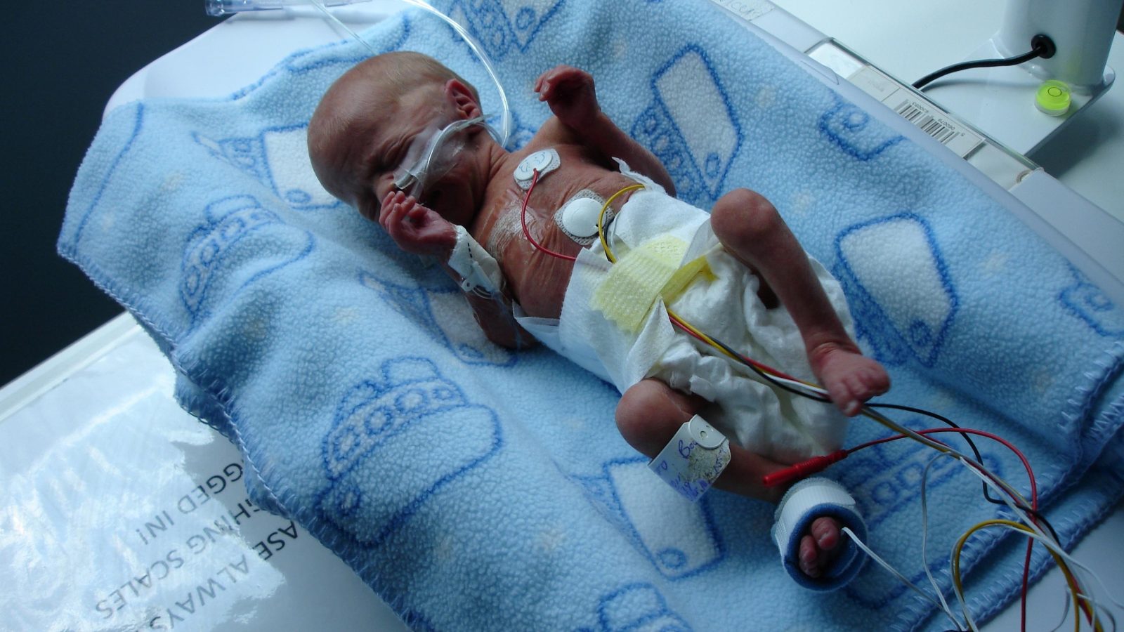 Baby Luke Allinson