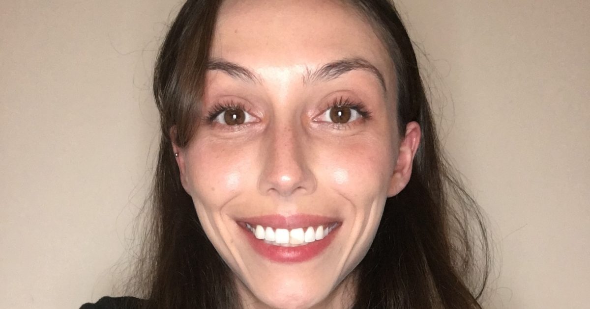 OpenGraph Image for Far from ‘fussy eaters’ - first neuroimaging study demonstrates significant changes in the brains of children with ARFID symptoms